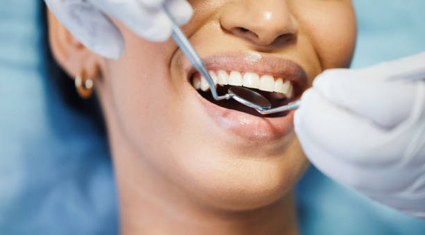 Best Emergency Dental Extractions in Cinco Ranch, TX